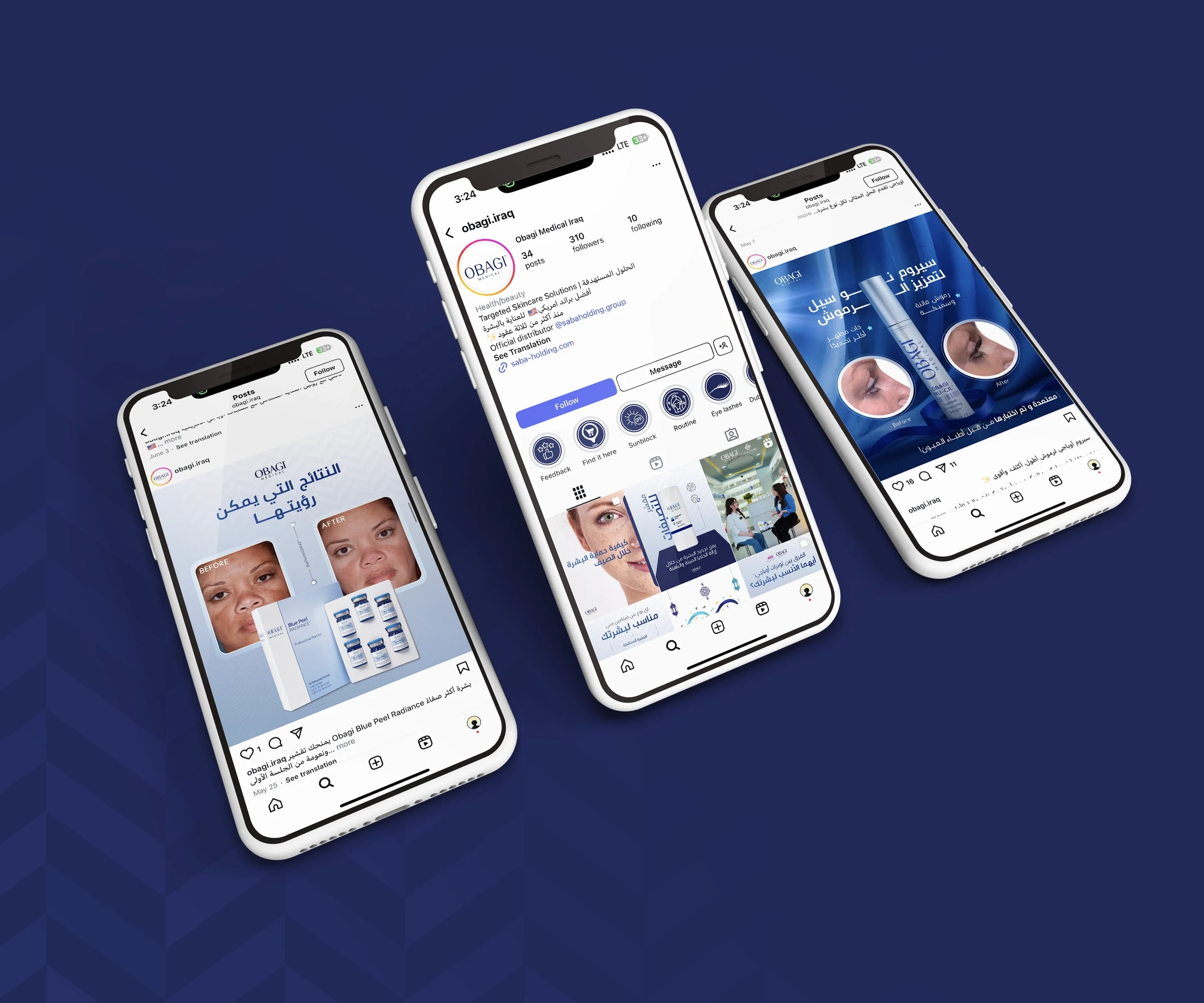 Obagi Medical — Project image 5